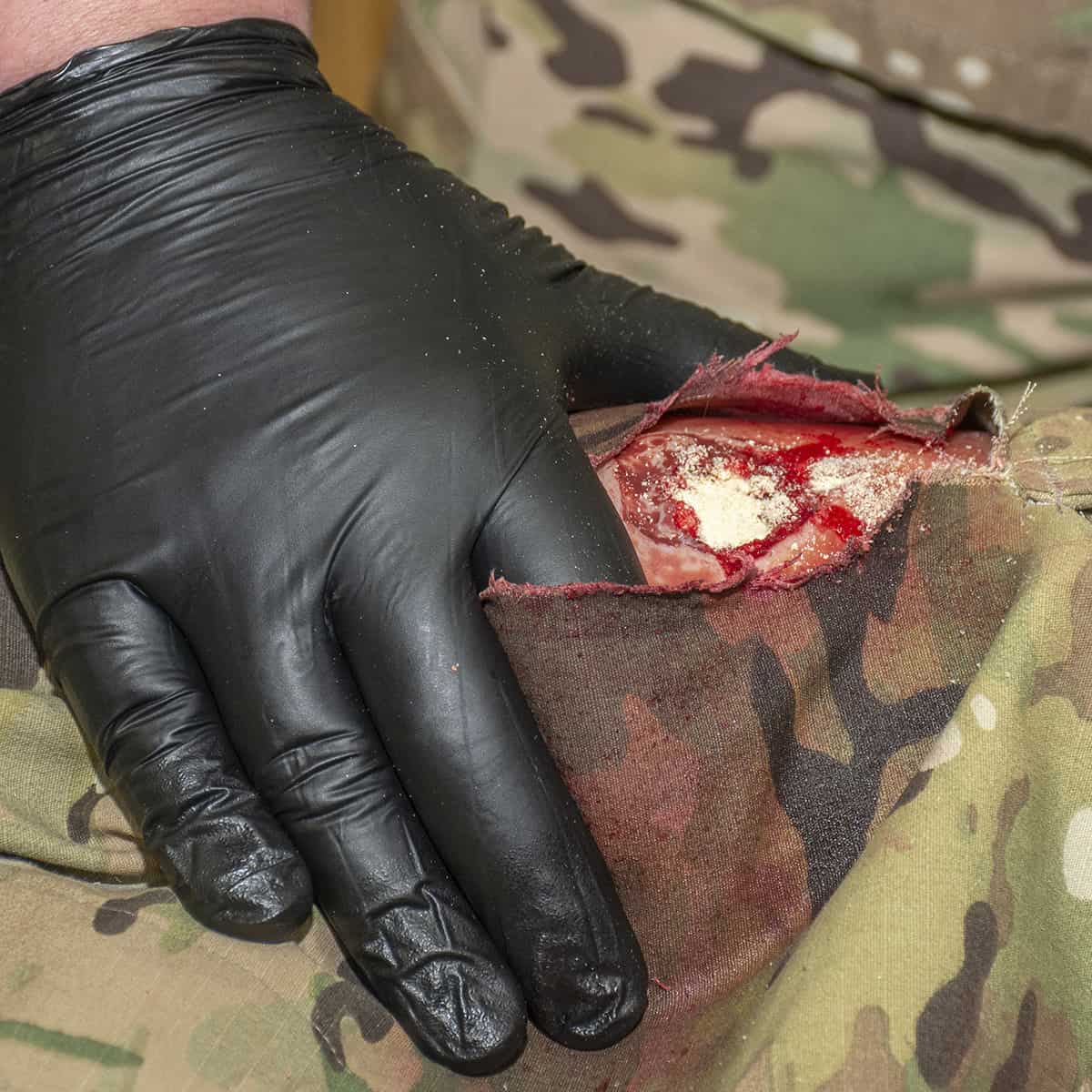 Celox-A High Speed Applicator - Image 4