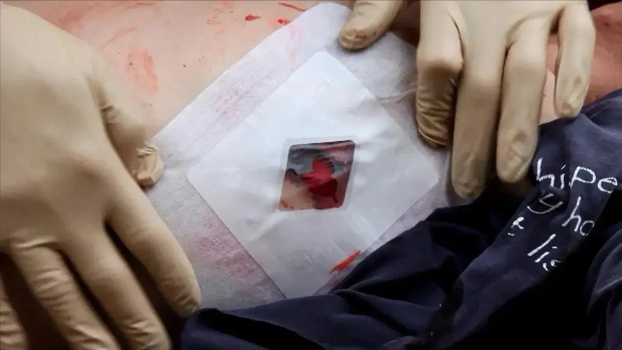 Russell Chest Seal - Image 4